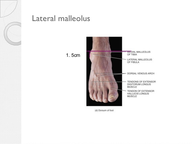 Lower Limb Anatomy, Palpation & Surface Markings, 1e